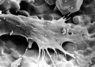 그림 4) Hydroxyapatite 세라믹 표면에서 성장시킨 인간의 뼈세포. 나노 기술의 발전으로 세포의 인공적인 배양이 가능하게 되었다.